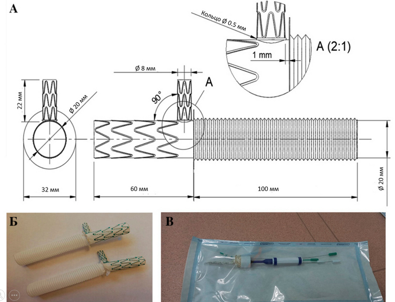 2. Модель протеза аорты, созданного в Центре Мешалкина.jpg